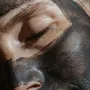 VOONO - Sérum na akné 15 ml